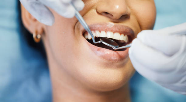 Best Emergency Treatment for Dental Infections or Abscesses in Richmond, IN